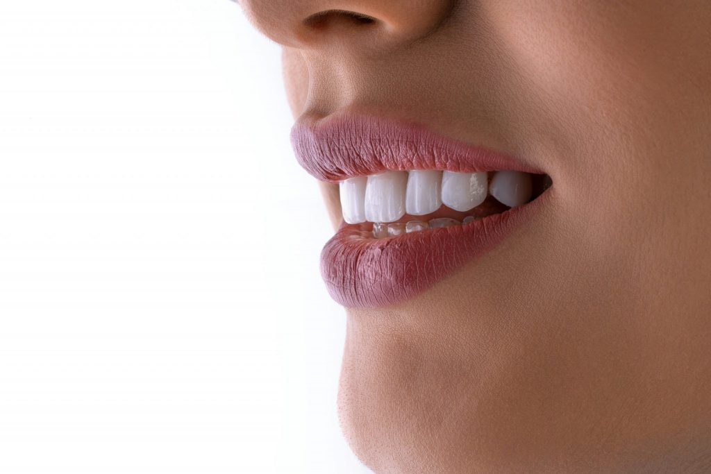 Smiling woman showing bright teeth after dental implants in Turkey